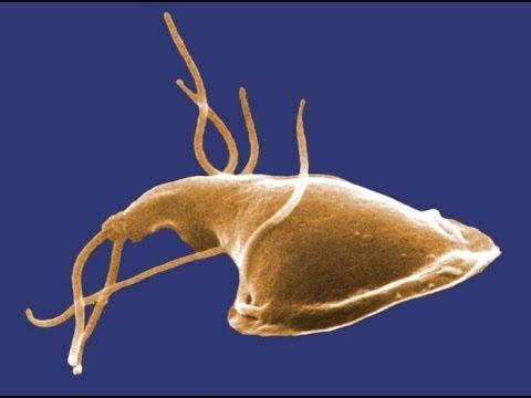 Giardia lamblia - Central Contra Costa Sanitary District